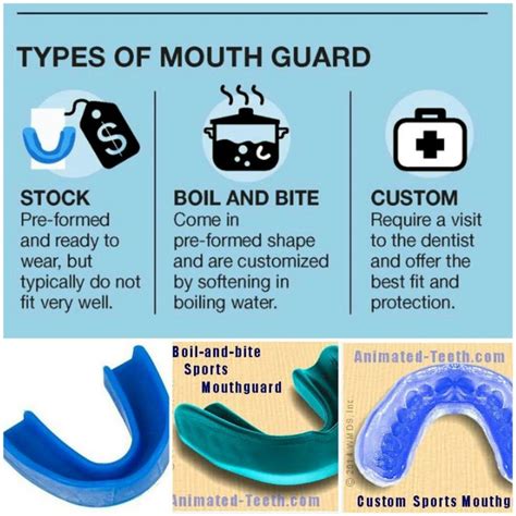 mouthgaurd in albion|A review of mouthguards: effectiveness, types, characteristics and.